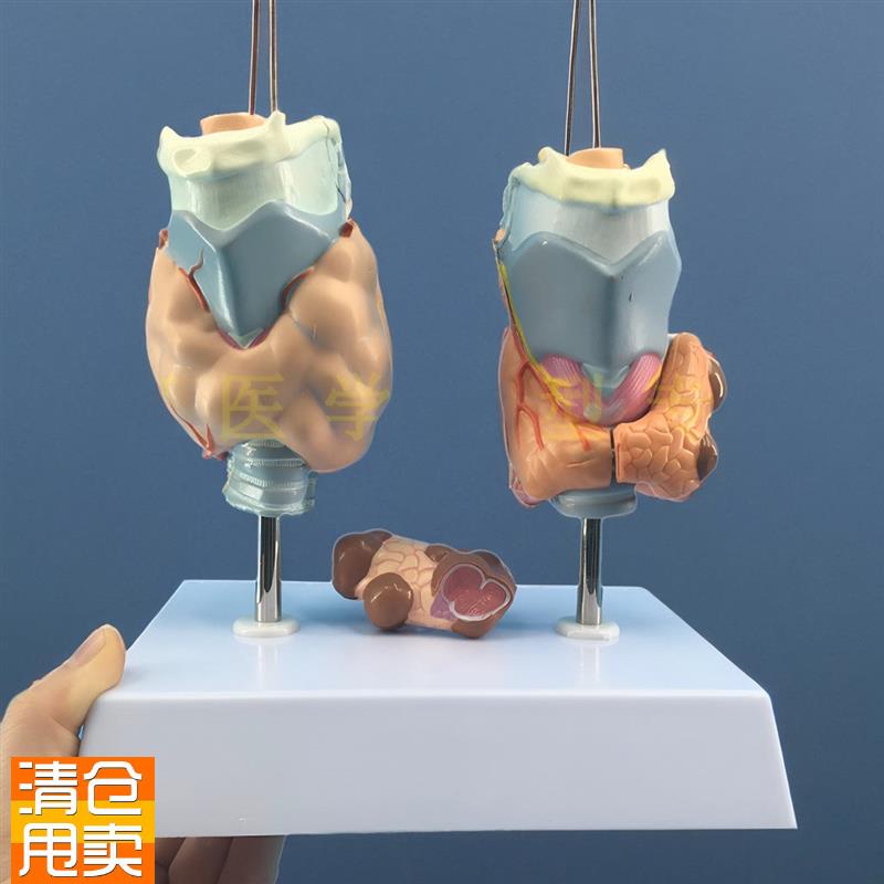 甲状腺病变甲状腺病理模v型甲亢甲低甲减人体内分泌系统模型