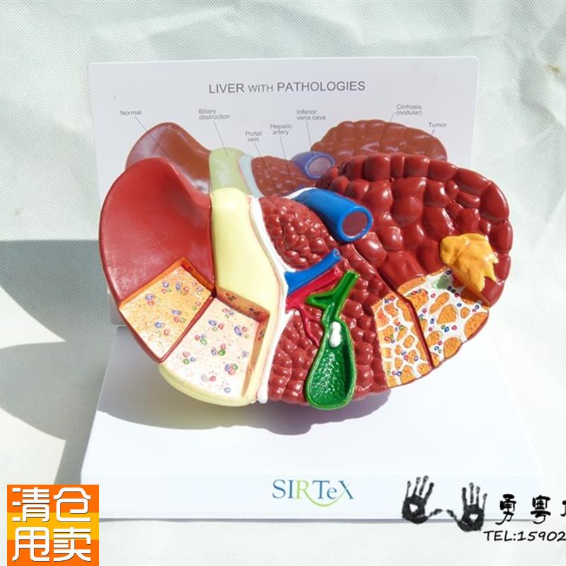 人体肝脏解剖模型人体内脏教学演E示肝模型内脏肝解剖人体模型