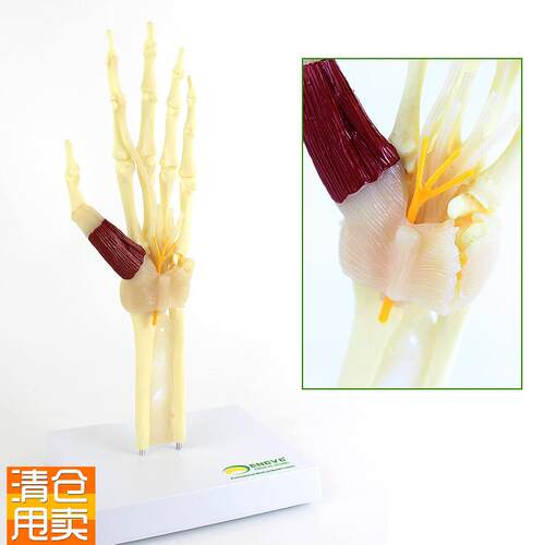 ENOVO颐诺人体腕p关节综合征模型腕管综合征正中神经肘关节桡