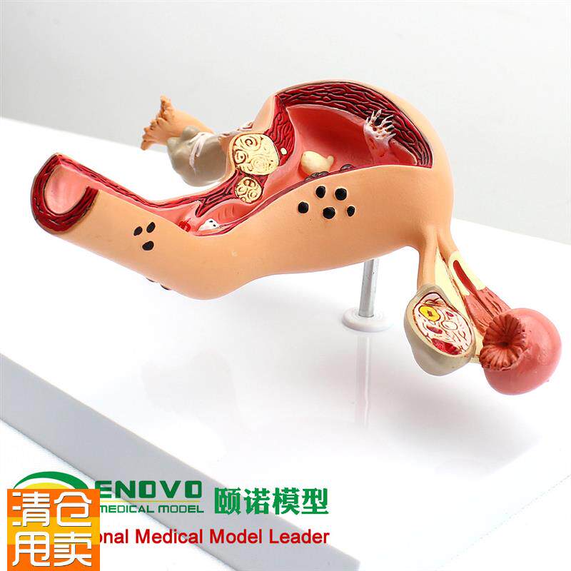 颐诺正品人体g子宫卵巢阴道疾病模型生殖科妇科医用医患模型