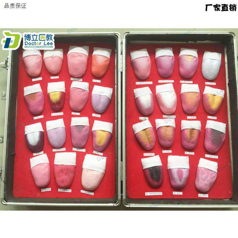 人体舌头舌苔常见病变n比较模型口腔护理医用教学人体模型