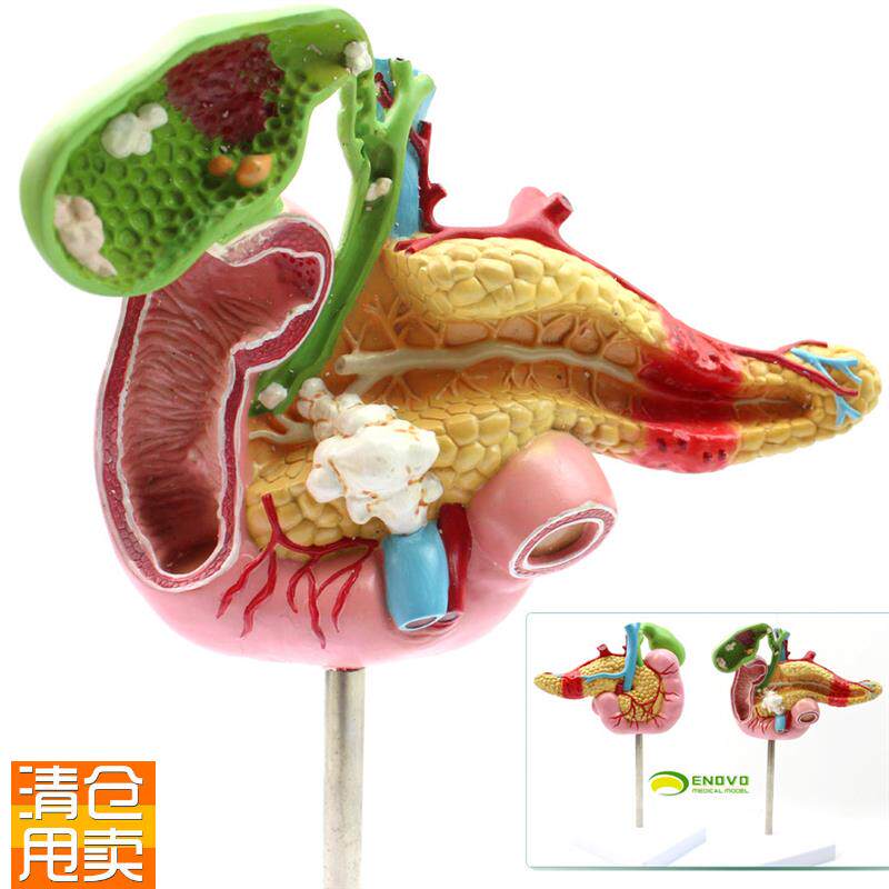 ENOVO颐诺医学胰腺十二指肠胆囊D病理模型外科消化科系统模具肝胆