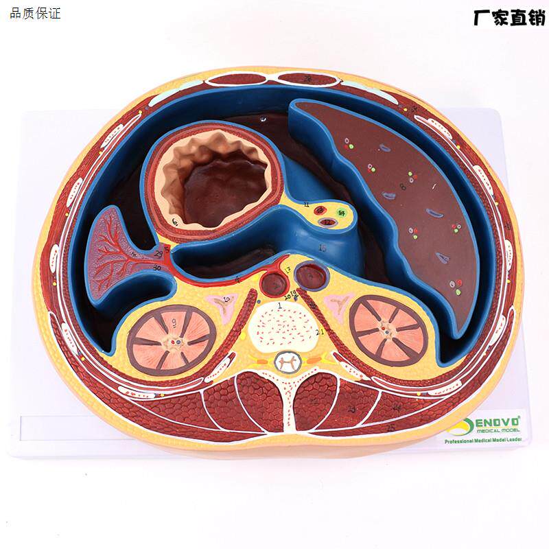 ENOVO颐诺人体K腹部断面模型平网膜网膜囊孔结构解剖标本