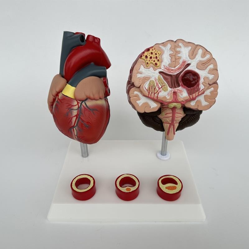 人体心脑血管展示模型q血压高心脏模具与心血管模型 对比教具模型