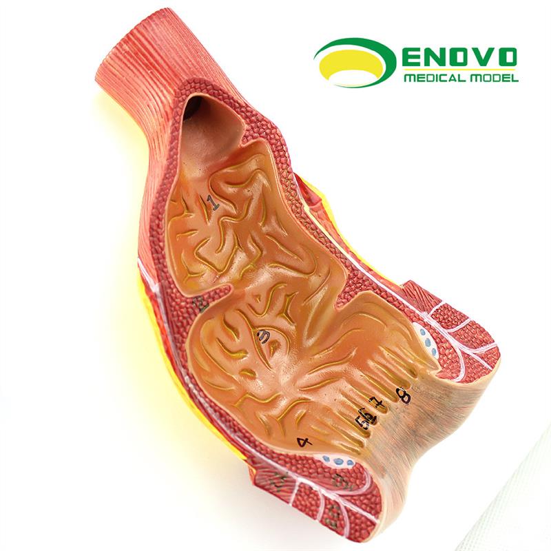 ENOVO正品医用人体直肠肛管肛门解剖结构模型肛肠科外.科消化系统