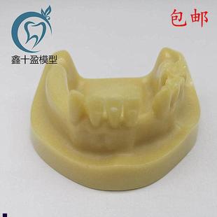 牙科材料下半口种植练习模型发泡缺失种植练O习教学模型M2028
