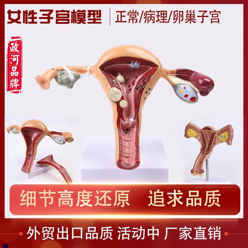 人体模型女性生殖病理子宫阴道A卵巢医用教学模具病理变化培训器,玩具/童车/益智/积木/模型,其他模型玩具,淘宝优惠券,粉丝福利购,淘宝优惠卷