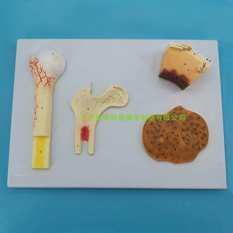 长骨结构 骨的结构模型 血管松质骨密质骨 M股骨哈弗系统 骨骼解