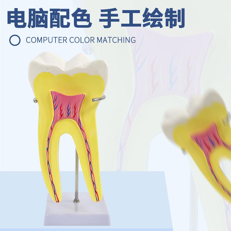 人体磨牙解剖模型 幼儿园教具医学教学I大型牙齿通用 配底座支架