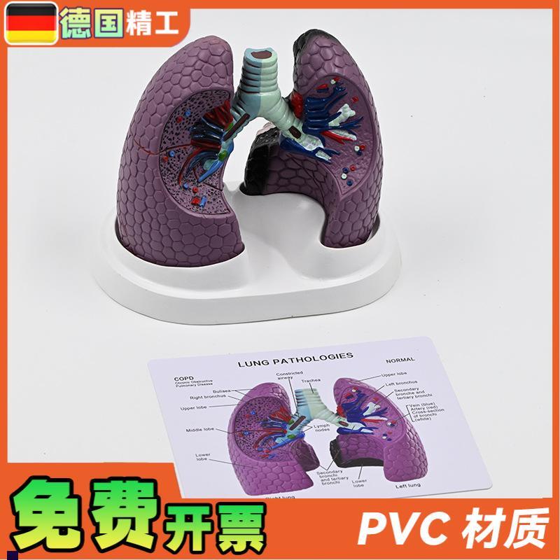 德国】人体肺模型吸m烟病变肺呼吸科标本健康肺胸外科肺部解剖健