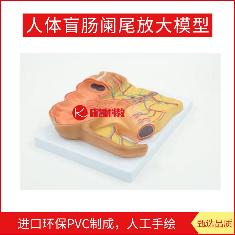 人体盲肠阑尾放大模型尾升结回肠血管淋巴消化Q系统医用教学模型