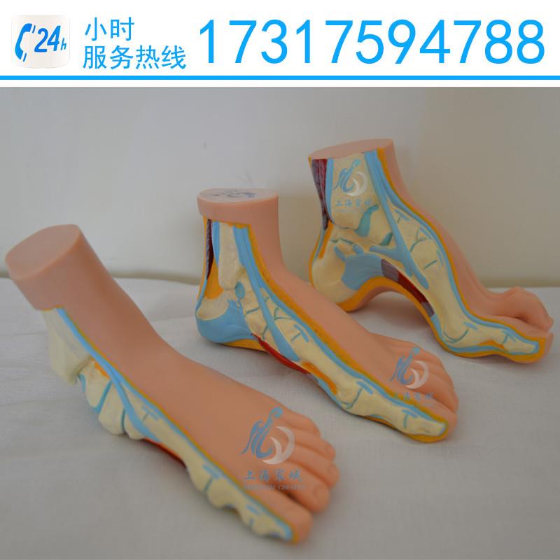 正常足扁平足O弓型足模型