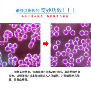 低频共振仪深度解析：原理、应用场景、选型要点与厂家批发采购指南