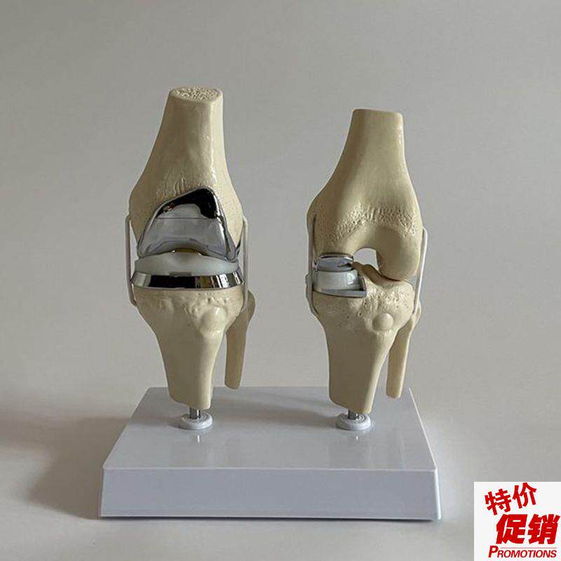 人工膝关节模型膝盖置换仿真假体半E月板软骨胫骨平台髋关节替换