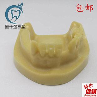 牙科材料下半口种植练习模型发泡缺失种植M练习教学模型M2028