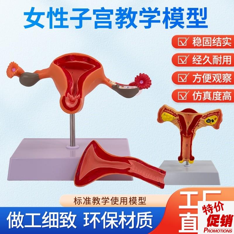 女性生殖模器h模型生殖科教具私密子宫模型教具妇科卵巢解剖