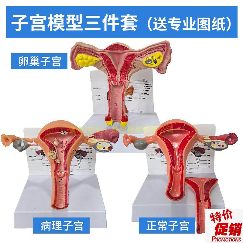 人体模型女性生殖子宫模型生殖卵巢模型教学模具病V理变化科学教