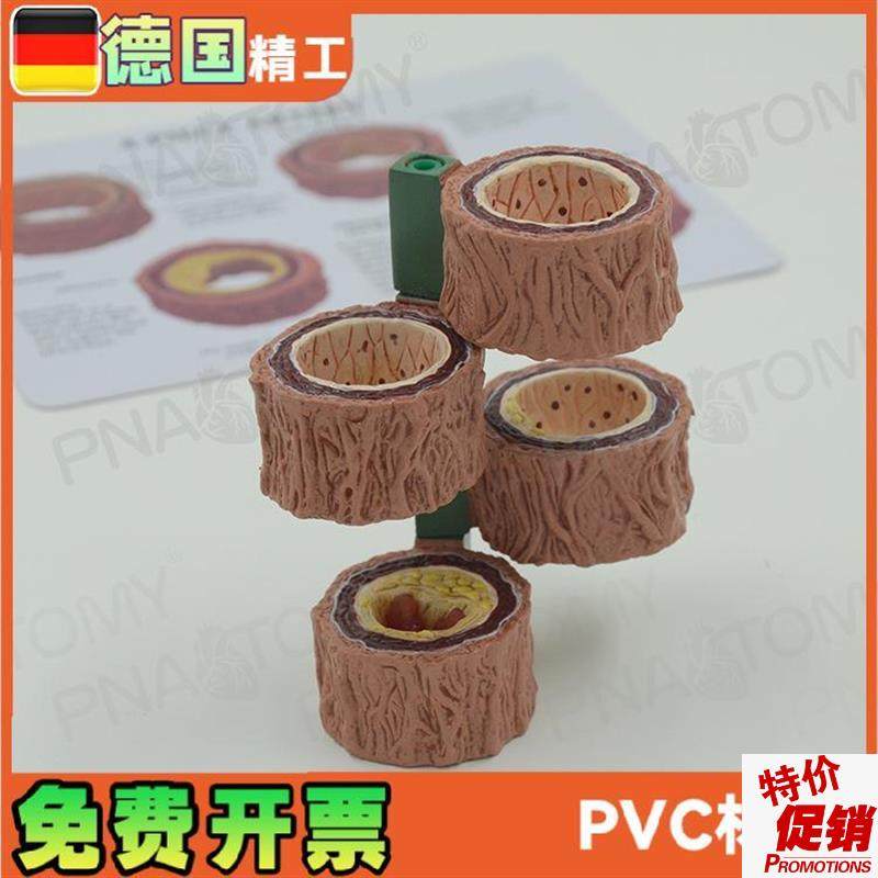 四阶段动脉血管模型粥样化演示教具血管L硬化解剖展示模具礼品