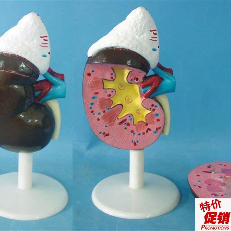 人体肾脏解剖模型器官解剖医用教学讲Y解展示标本