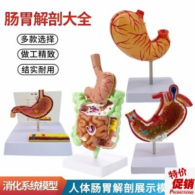 人体大肠病理模型肠胃解剖x模型大肠盲肠直肠十二指肠模型