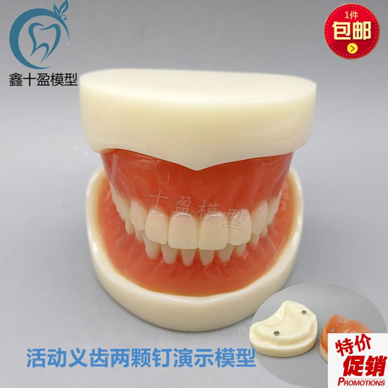 牙科模型活动义齿牙模讲解模型全口义H齿两颗钉教学模型T21包邮