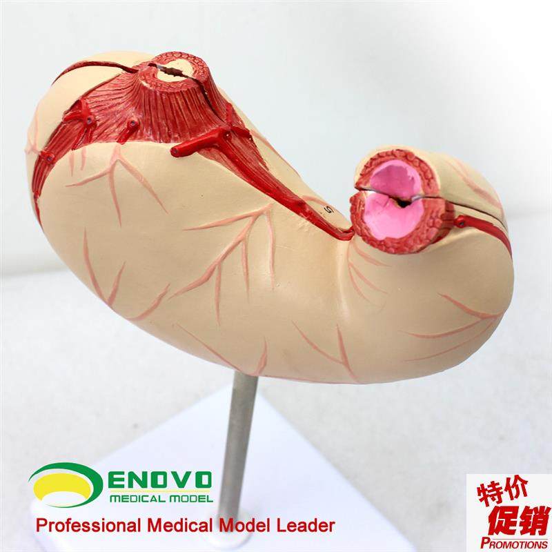 颐诺正品胃解剖结构模型胃模型人体I消化系统器官医用解剖模型