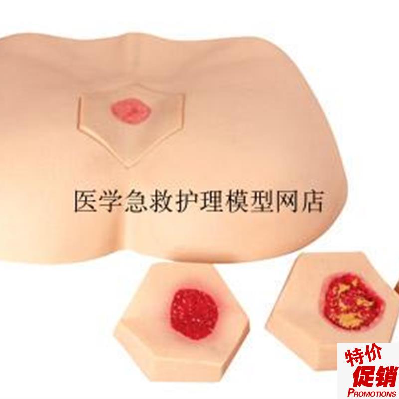 阶段褥疮护理模型护理操作不同阶段四个临S床分期成人臀部