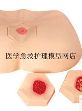 阶段褥疮护理模型护理操作不同阶段四个临S床分期成人臀部