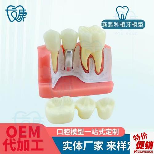 4倍种植牙模型种植体r分析冠演示牙模型种植体模型口腔教学模