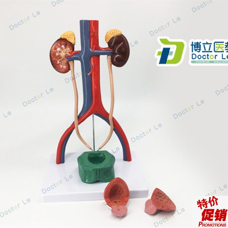 人体泌尿系统模型肾输尿管膀胱尿道解H剖模型医学泌尿科泌尿模型