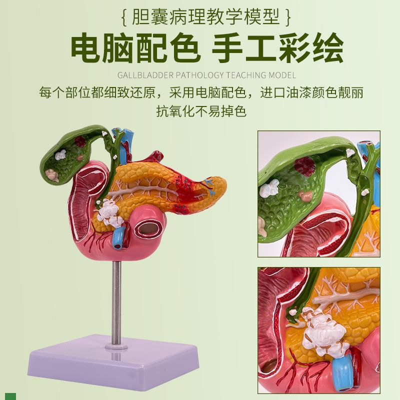 仿真病变胰腺十二指肠胆囊病理模型消化系统肝脏胰脾X肠道标本教