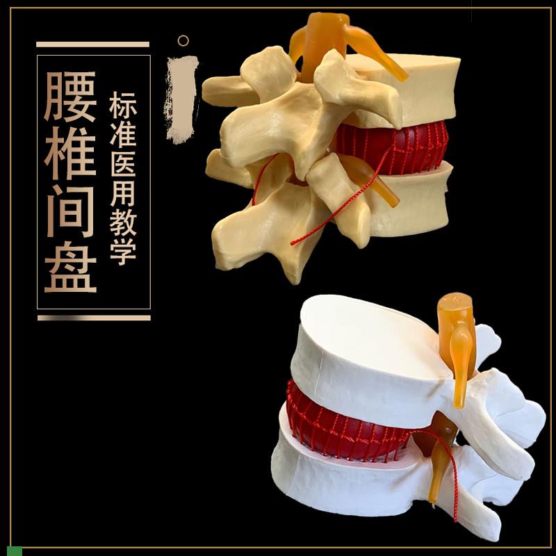 医用人体腰椎间h盘TU出演示模型腰椎D病变模型脊柱脊椎模型包邮