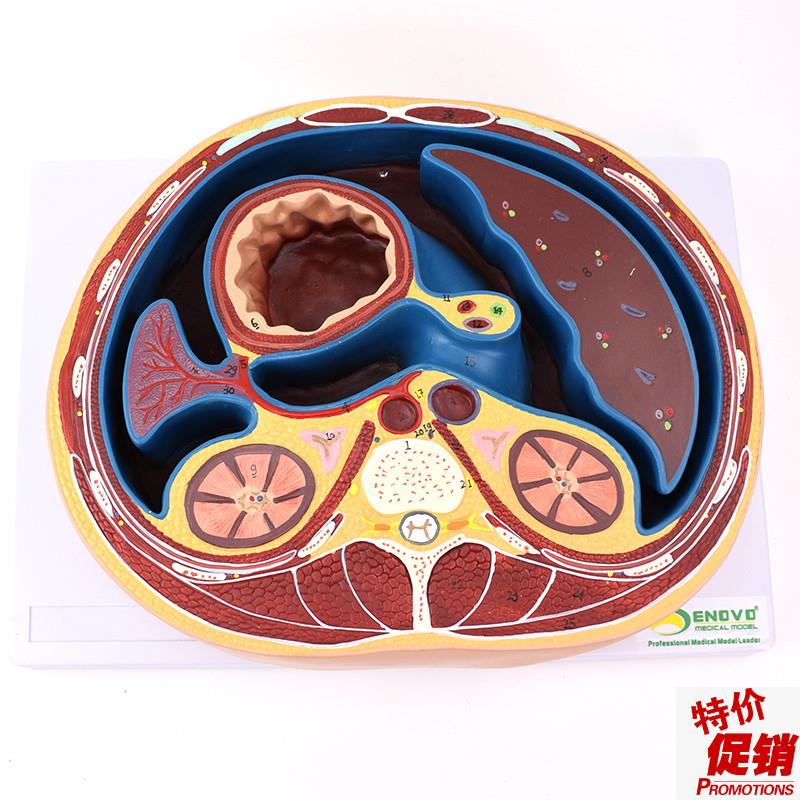 ENOVOc颐诺人体腹部断面模型平网膜网膜囊孔结构解剖标本