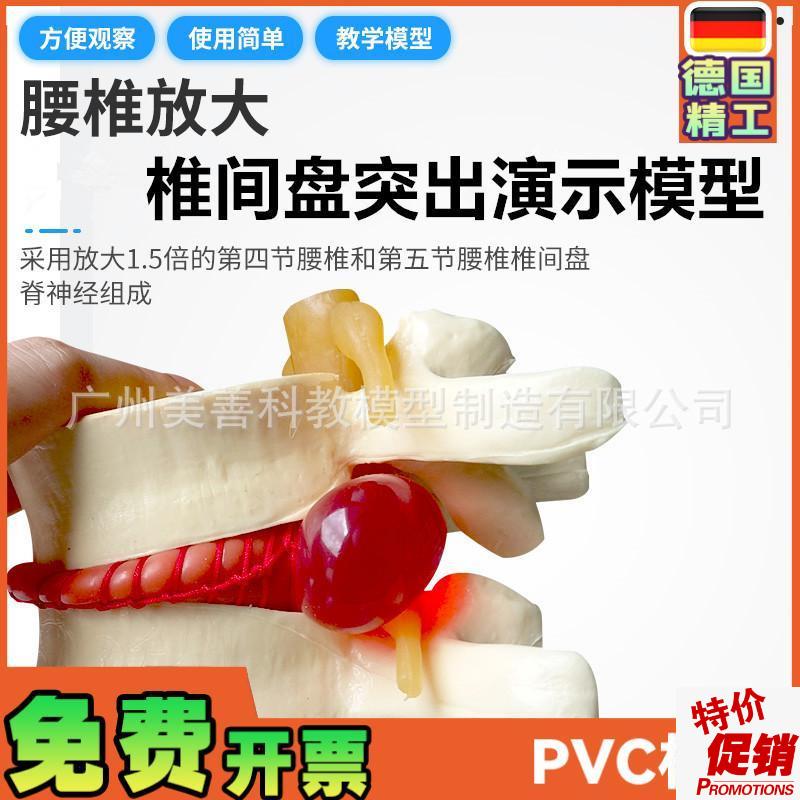 椎间盘模型正品医学人p体腰椎突出脊柱脊椎骨病理演示关节标准模