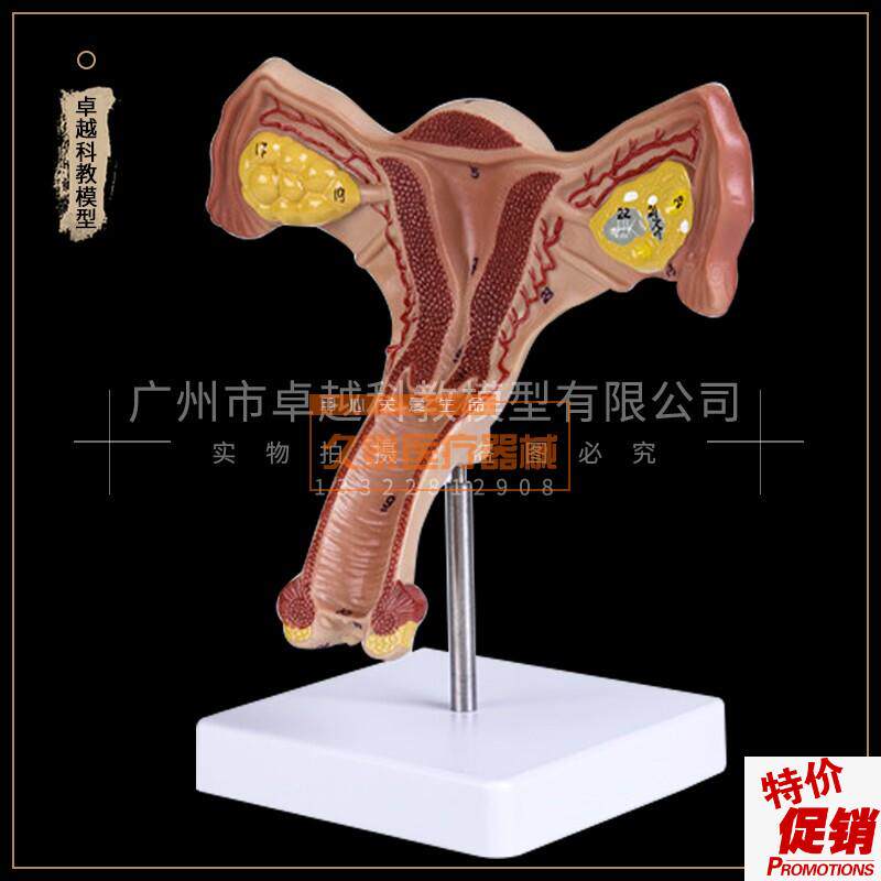 人体子宫卵f巢阴道女性内外生殖器官模型生殖科妇科医用演示