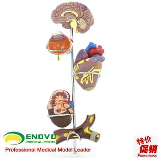 ENOVcO颐诺人体医学高血压模型大脑心脏血管内科普外科医生礼品