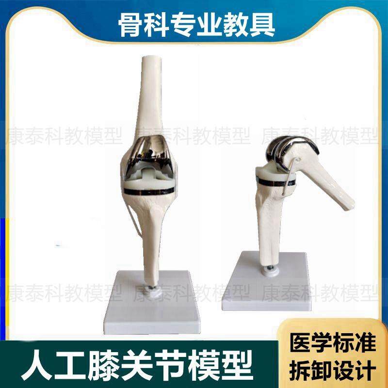 人工膝关节模型膝盖置换仿真假体半月板软骨胫骨平台Y髋关节替换