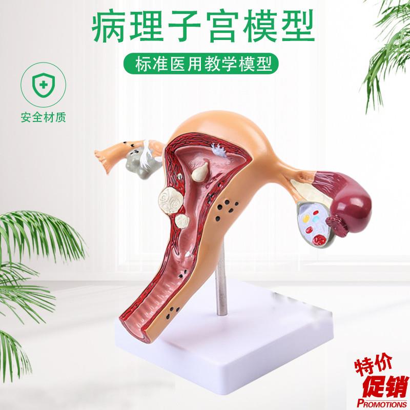 人体模型女性生殖子宫阴道卵巢子宫教G学模具病理变化科普培训教