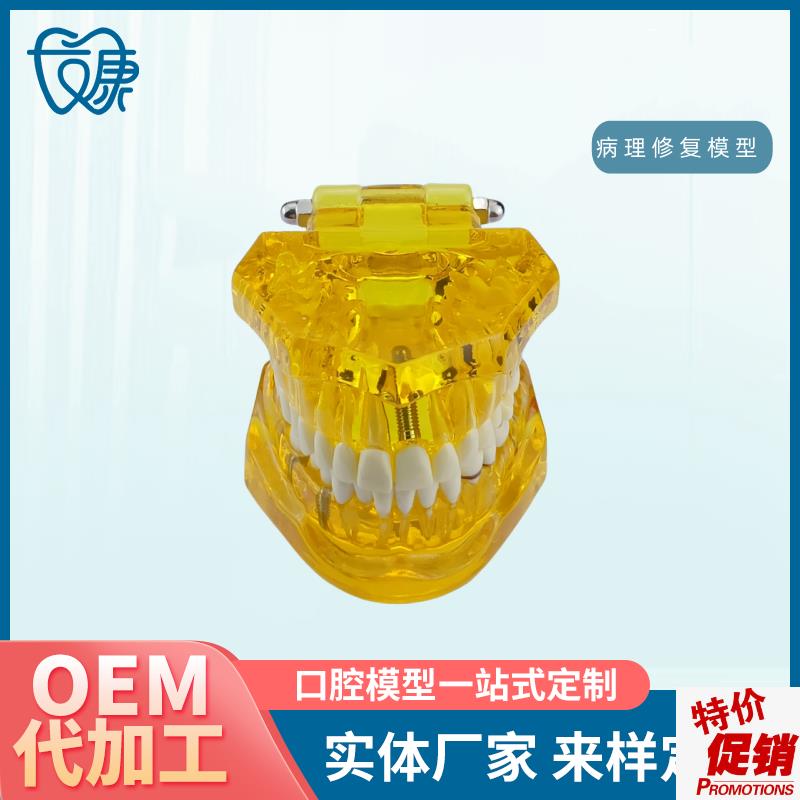 牙齿模型病理修复可拆p卸正畸口腔病理牙模型牙科医患活动沟通