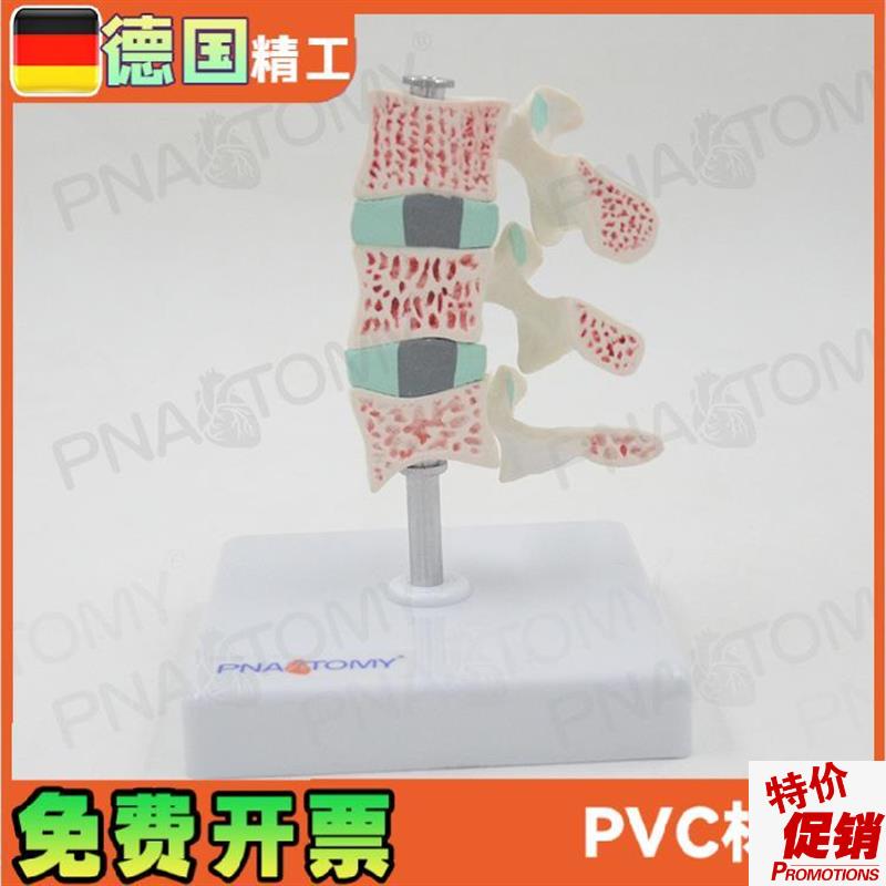 医学人体椎间盘腰椎骨质疏松模z型骨科疼痛科老年疾病护理康复模