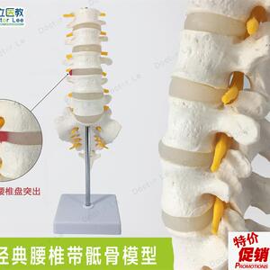 高端医用可拆成人5节腰椎尾骨模型脊椎椎间盘S突出人体标本模型