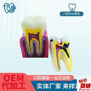 6倍对比模型牙科k教学器材6倍龋齿对比模型口腔模型教学牙齿模型