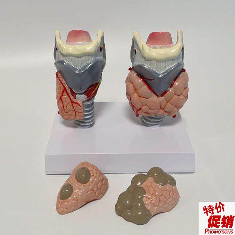 康泰教具甲状腺模型增大囊内分泌医E药促销礼品医院科室临床教学,玩具/童车/益智/积木/模型,其他模型玩具,淘宝优惠券,粉丝福利购,淘宝优惠卷
