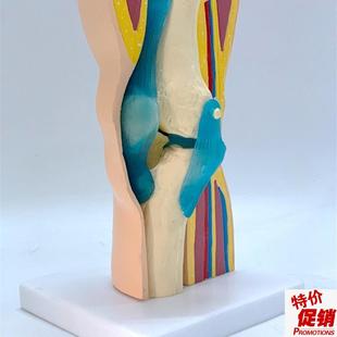 人体膝关节功能模n型骨骼骨架模型教学医用模型关人体节模型