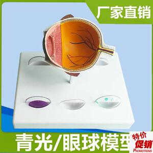 病理眼球模型青光白内角膜受损眼睛结构可拆卸视e网膜眼底检查神