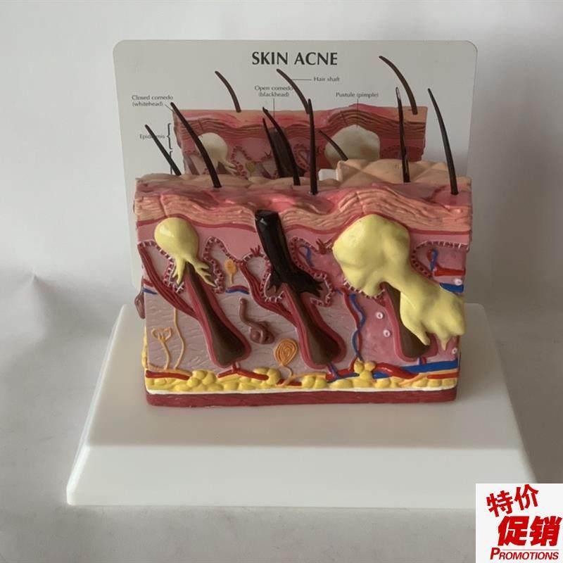 人体皮肤放c大皮肤痤疮毛发生长头发健康皮肤脱发毛囊毛细血管黑,文具电教/文化用品/商务用品,教学标本/模型,淘宝优惠券,粉丝福利购,淘宝优惠卷
