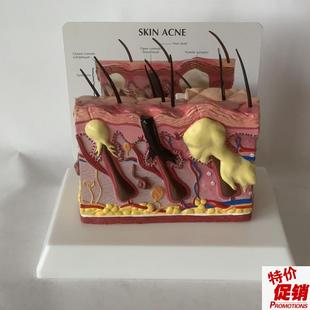 人体皮肤放c大皮肤痤疮毛发生长头发健康皮肤脱发毛囊毛细血管黑