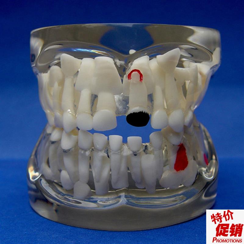 ENOVO颐诺儿童乳o牙早期病态牙列模型牙齿发育幼儿牙齿护理教学具