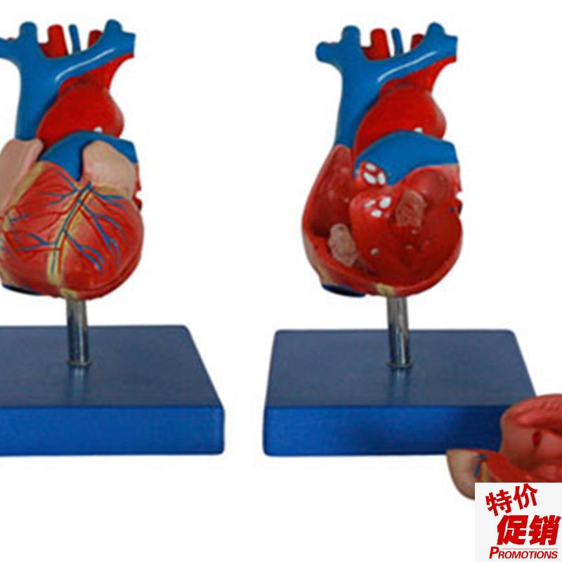 新型自然大w心脏解剖模型