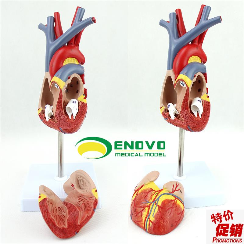 ENOVO颐诺人体心脏模型医学心血管内科心脏介入解剖X教学冠状动脉